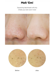 Blackhead Care 3-Step Set(Cleansing Oil + Toner + Cream)