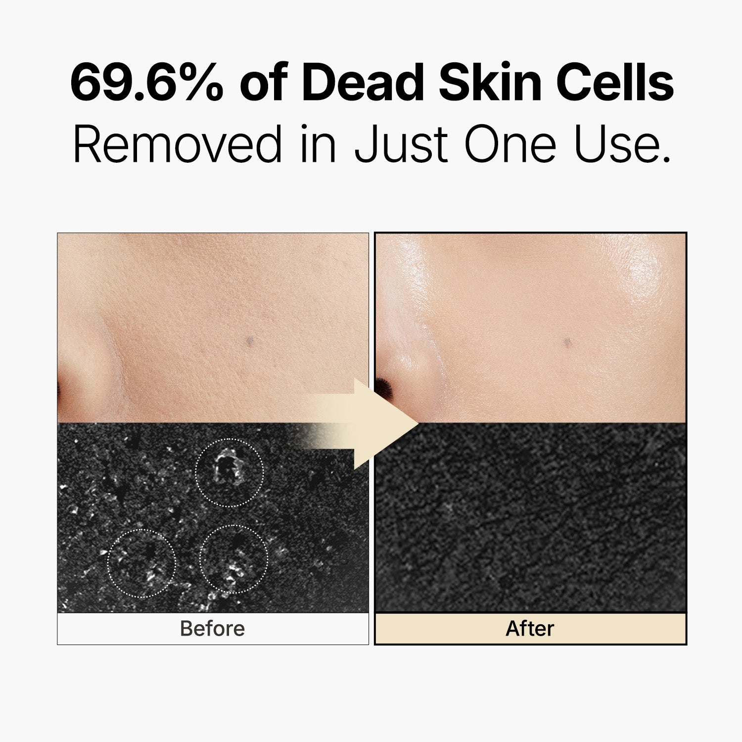 Galactomy Enzyme Peeling Gel