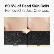 Galactomy Enzyme Peeling Gel
