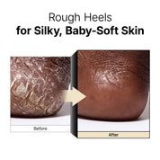 Galactomy Enzyme Peeling Gel