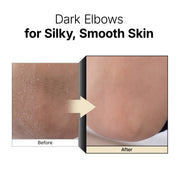 Galactomy Enzyme Peeling Gel