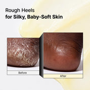 Pure Aqua Peeling Gel, Face Exfoliator