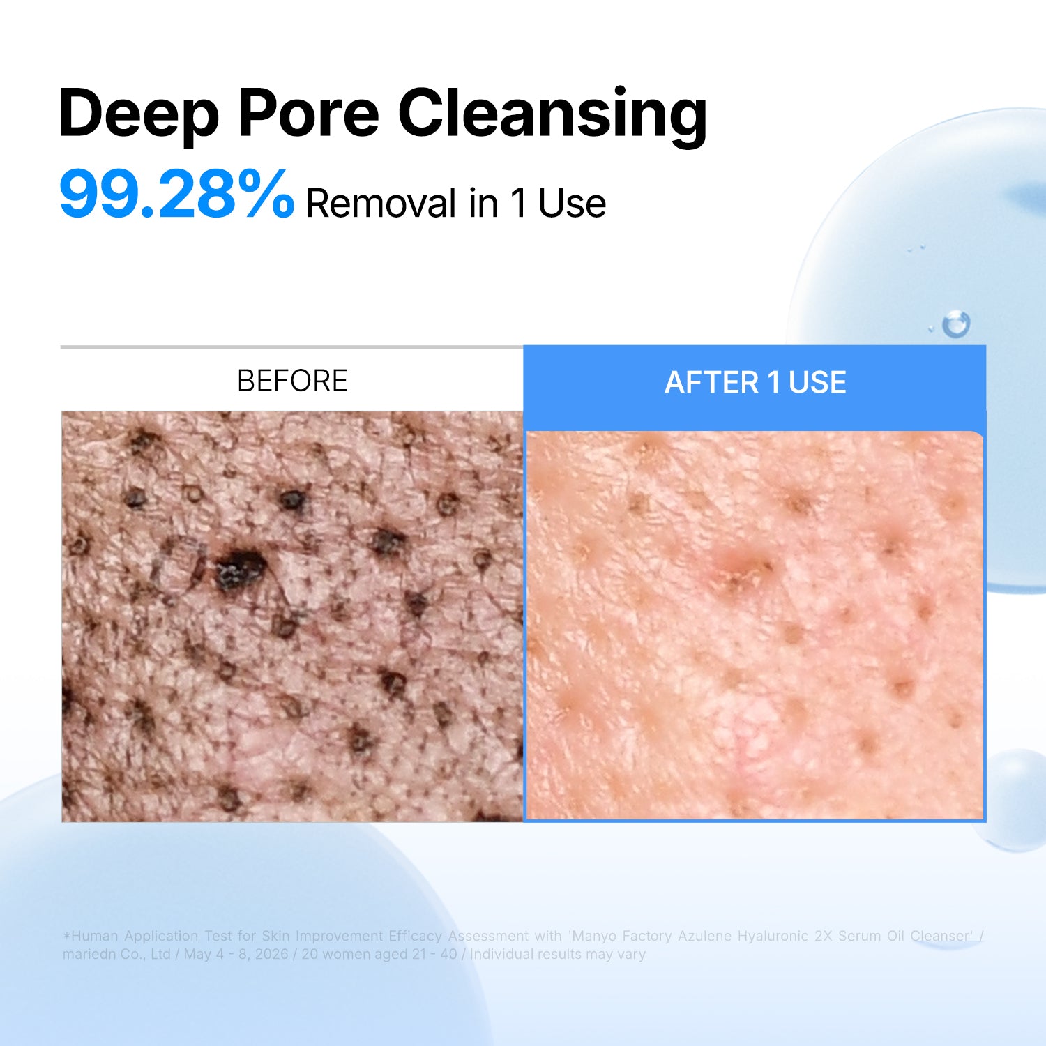 Azulene Hyaluronic 2X Serum Oil Cleanser