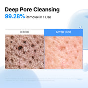 Azulene Hyaluronic 2X Serum Oil Cleanser