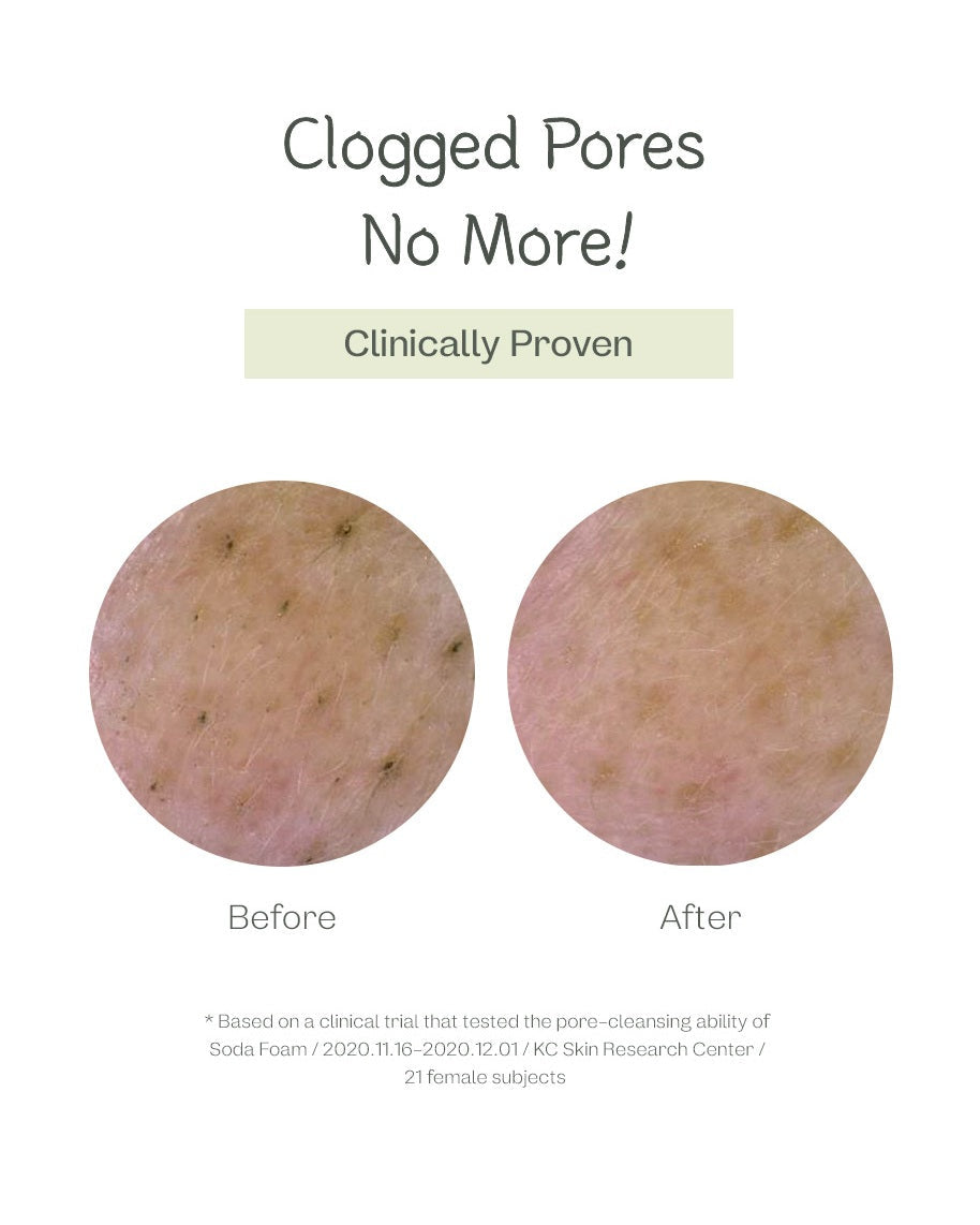 Deep Pore Cleansing Soda Foam